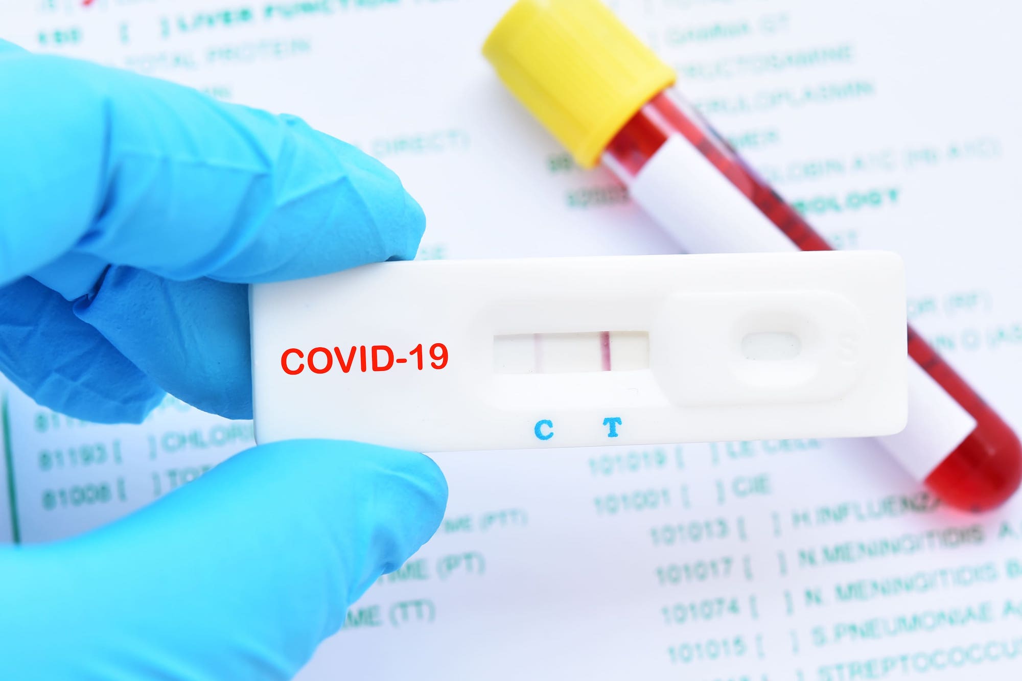 positive covid rapid test positive covid rapid test