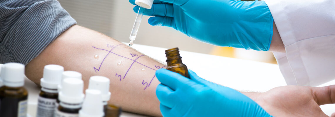 Allergologia