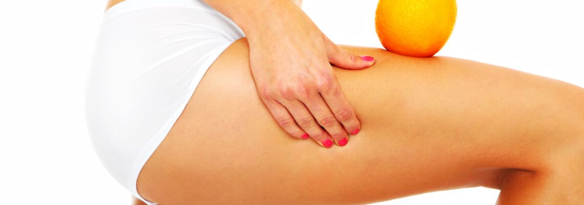 Cellulite? Ecco dei consigli per l’Estate!