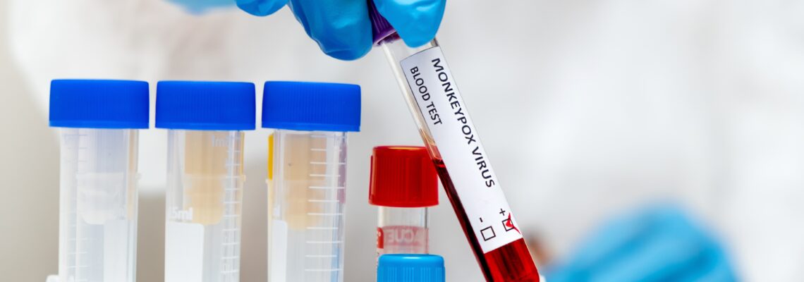 Vaiolo delle scimmie: la nuova emergenza sanitaria