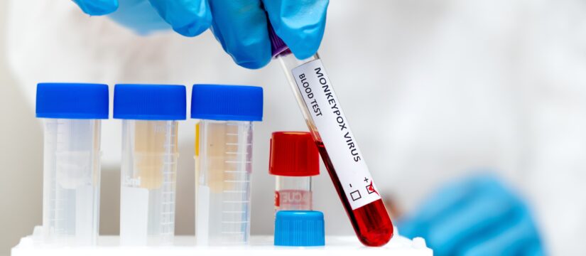 Vaiolo delle scimmie: la nuova emergenza sanitaria