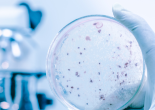 Candida Auris: tutto ciò che c’è da sapere